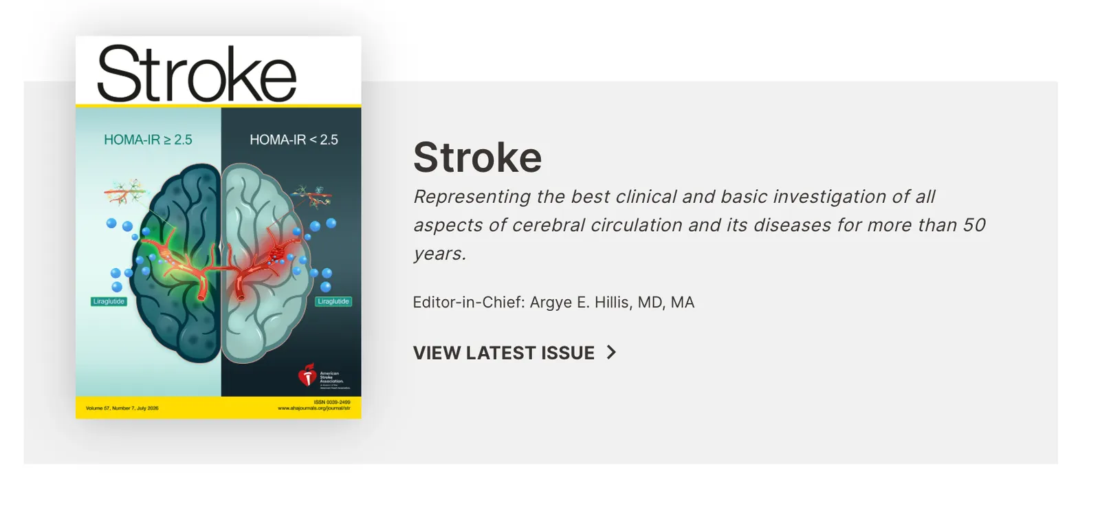 Six-part Focused Update on post-stroke seizures for Stroke